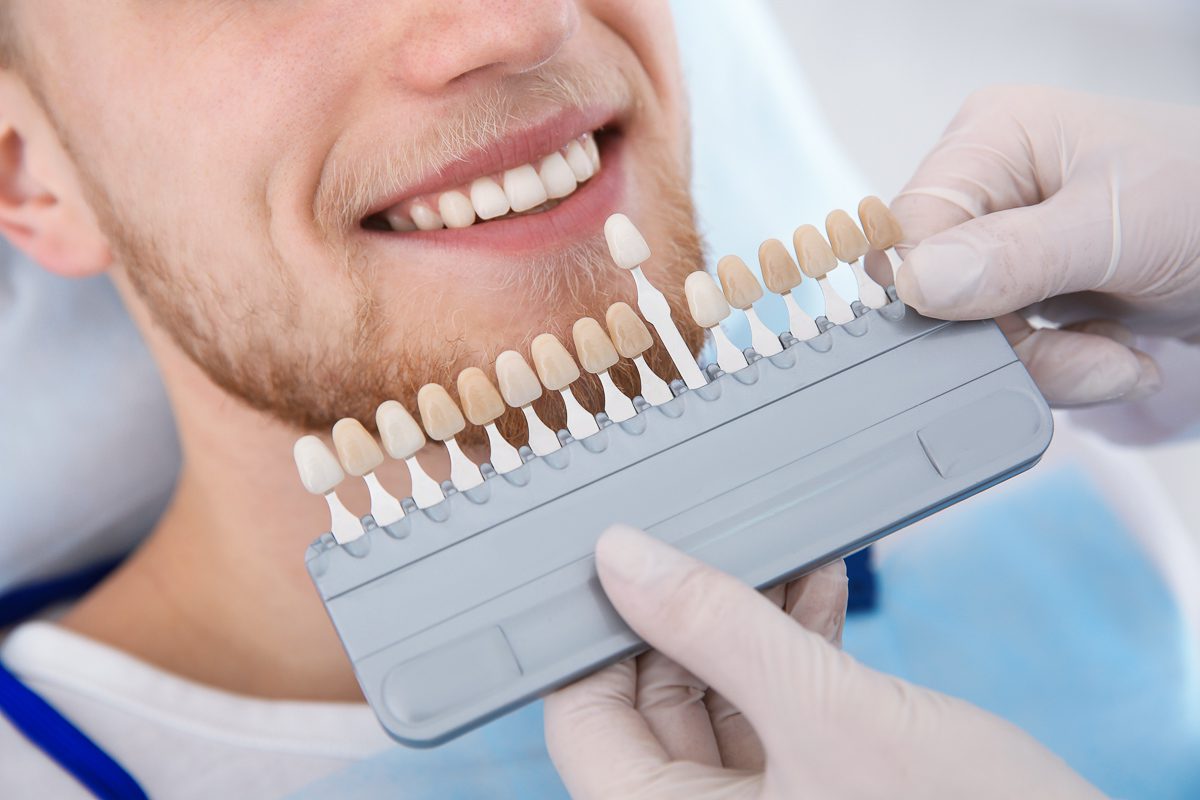 Can Cosmetic Bonding Repair a Chipped Front Tooth? - Indianapolis, Broad Ripple & Meridan-Kessler, Indianapolis Dentist - SoBro Blog - Dental Health Tips & Resources
